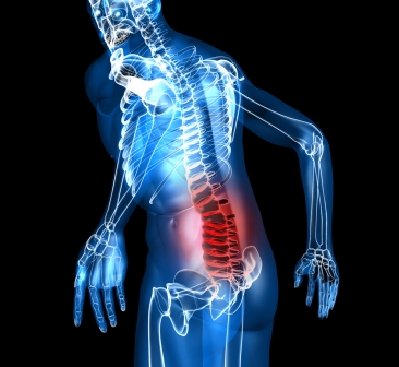 POSTURAL SYNDROME OF THE LOWER BACK